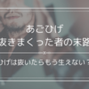 あごひげを全部抜く