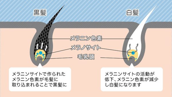 白髪の原因